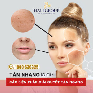 tàn nhang là gì